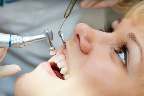 Cắm implant răng cửa như thế nào? - Bác sĩ tư vấn 3