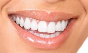Mang thai có tẩy trắng răng được không? Có ảnh hưởng gì không? 1