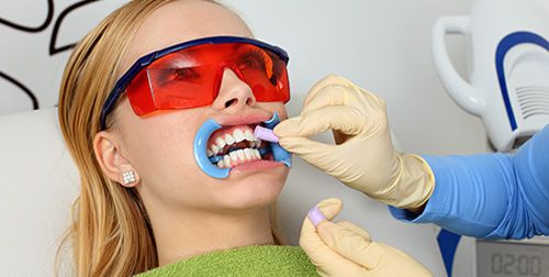Tẩy trắng răng bằng Laser Whitening bao nhiêu tiền? 2