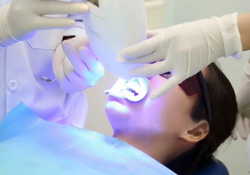 Tẩy trắng răng bằng Laser Whitening bao nhiêu tiền? 3