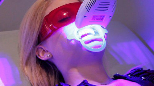 Tẩy trắng răng bằng Laser Whitening có hại không? 2