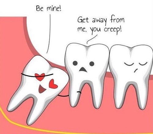 Răng khôn là răng nào và có cần giữ lại không? 1