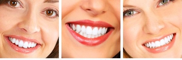 Răng sứ cercon 2