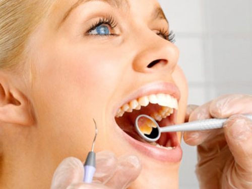 Chảy máu chân răng là thiếu vitamin gì? 2