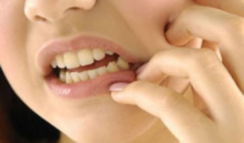 Cách xử lý khi mọc răng khôn gây hôi miệng 1