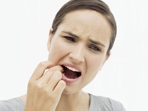 Răng khôn mọc lệch có nên nhổ không? 1