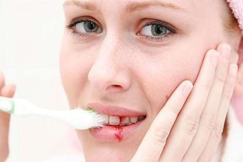 Dấu hiệu viêm chân răng dễ nhận biết 1