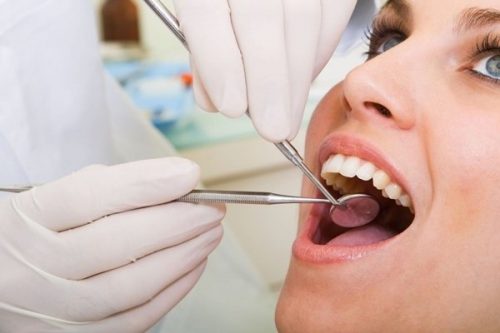 Dịch vụ niềng răng mắc cài inox cho mọi người 3