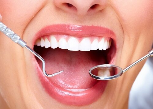 Cao răng nhiều lấy cao răng có đau hay không? 2