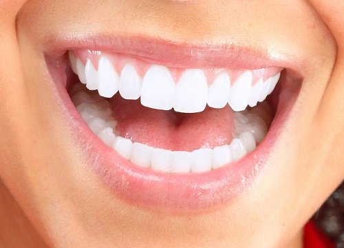 Cao răng nhiều lấy cao răng có đau hay không? 3