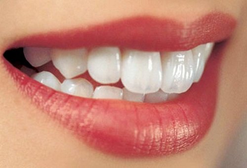 Trồng răng sứ mất bao lâu là hoàn thành quy trình?3