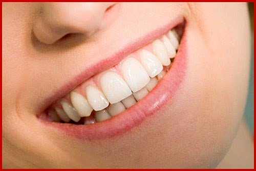 Ưu và nhược điểm của dịch vụ bọc răng sứ cercon 1