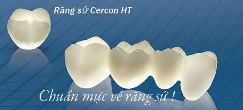 Ưu và nhược điểm của dịch vụ bọc răng sứ cercon 3