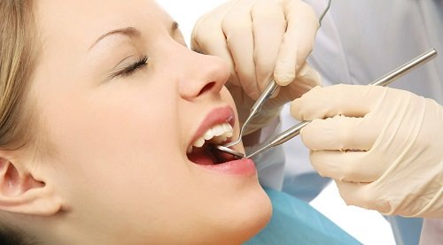 Bọc răng sứ ở đâu tốt hà nội? Thông tin nha khoa quan trọng 3