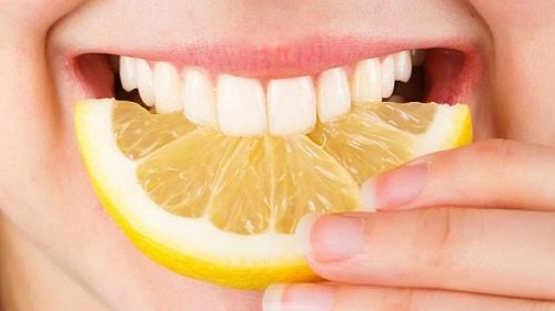 Bọc răng sứ zirconia - Ưu điểm và hạn chế 3