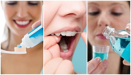 Bọc răng sứ kim loại có bền không? Chăm sóc răng đúng cách 3