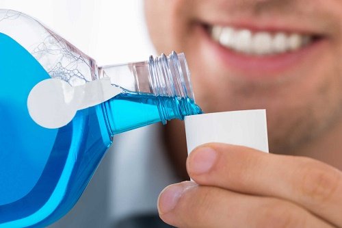 Bọc răng sứ veneer có tốt không khi bị nhiễm màu răng?4