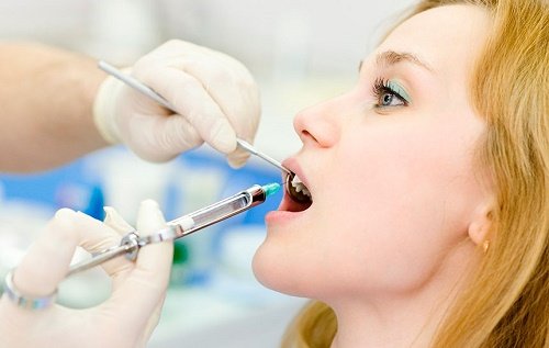 Dịch vụ nhổ răng khểnh có đau không thưa bác sĩ? 2