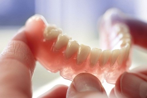 Răng sứ có bị sâu không? Bảo vệ răng sứ như thế nào? 1