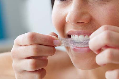 Miếng dán tẩy trắng răng loại nào tốt? Được sử dụng ra sao 1