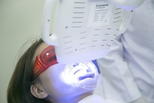Bột tẩy trắng răng eucryl có tốt không? Chuyên gia giải đáp 3