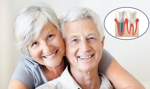 Trồng răng giả cho người già cần phải lưu ý gì? 2