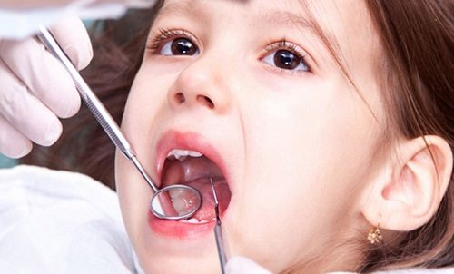 Bệnh viêm chân răng ở trẻ em - Cách điều trị 2