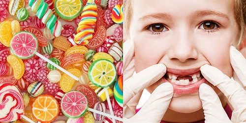 Thực phẩm gây sâu răng ở trẻ em - Top 5 cần lưu ý 2