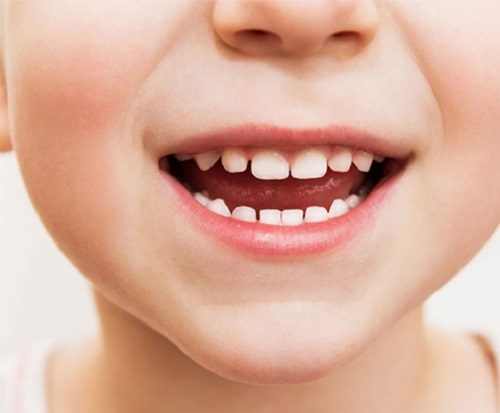 Răng trẻ em bị ố vàng - Biện pháp xử lý hiệu quả 3